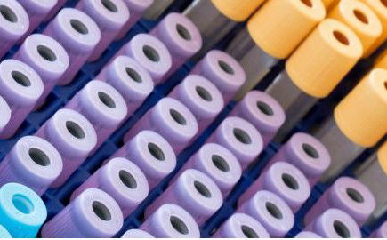 Test